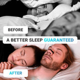 Patented Nasal Dilator Snoring Aid | Anti-Snore Starter Kit